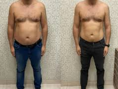 Resultado antes e depois 2