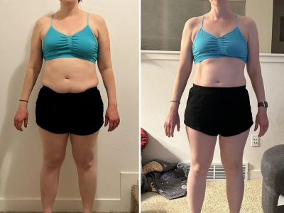 Resultado antes e depois 3